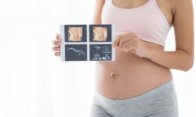 těhotná žena drží fotky z ultrazvuku