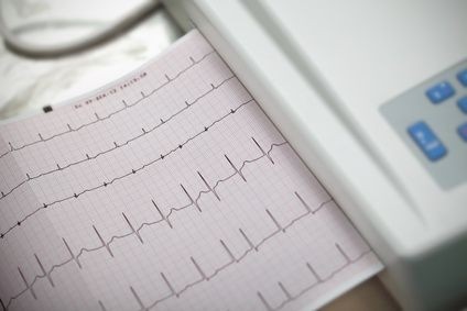elektrokardiogram