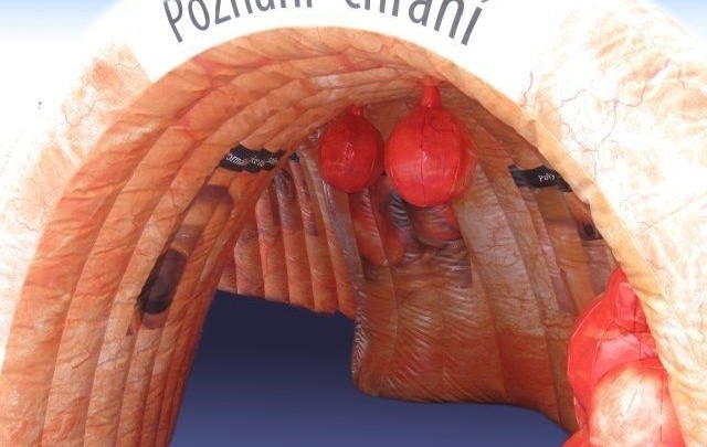 prezentace střevo-tour