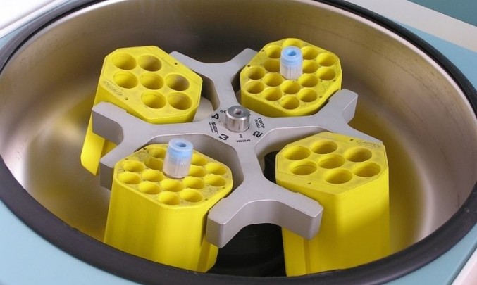 centrifuga,transfuze, krev, dárce, zdravotníctvi, jehla