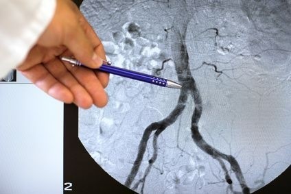 Angiografie