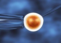 Umělé oplodnění,IVF,vajíčko