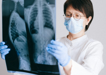 Lékařka se snímkem z rentgenu