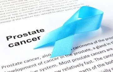 noutati tratament cancer prostata